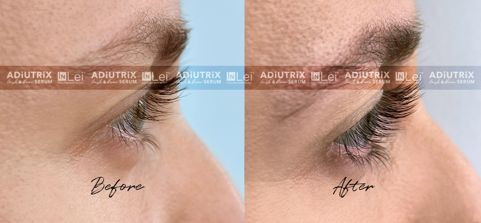 InLei_ADIUTRIX_SIERO_PRIMA_DOPO_2-1536×711 InLei_ADIUTRIX_SIERO_PRIMA_DOPO_2-1536x711